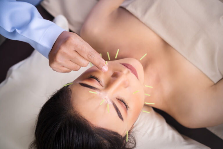 Acupuncture in Courtice and Peterborough.